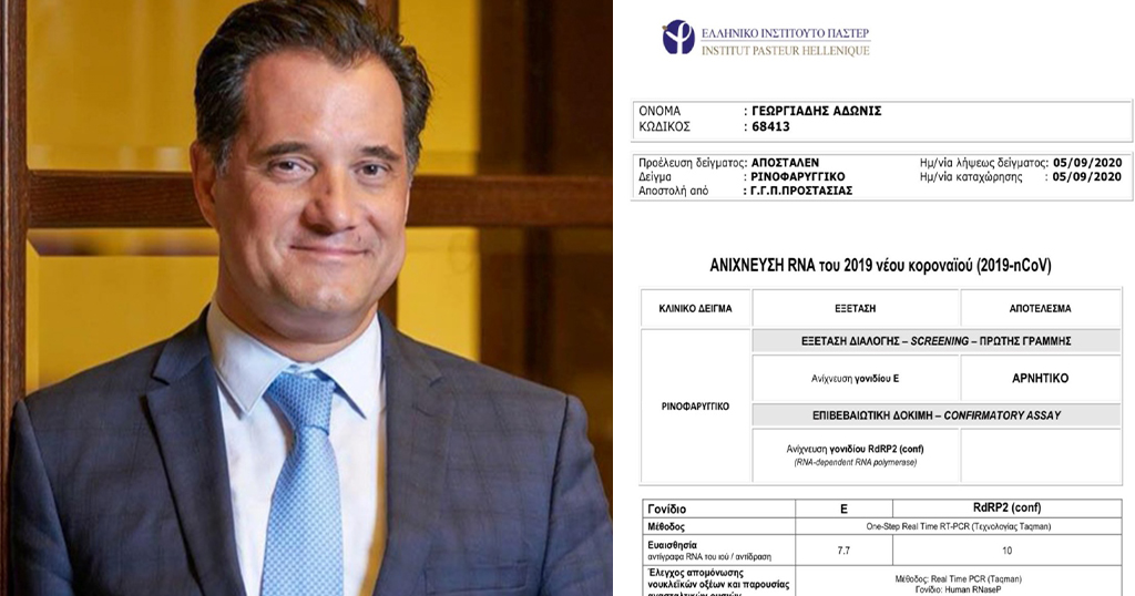 Άδωνις Γεωργιάδης: Δημοσίευσε το τεστ κoρoνοϊού που έκανε