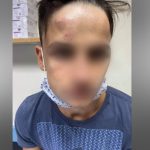 Αστυνομικός είπε στην μητέρα του 17χρονου που τον χτύπησαν 20 άτομα, να μην υποβάλει μήνυση
