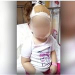 Κορινθία: Σκυλιά δάγκωσαν στο κεφάλι κοριτσάκι σε παιδική χαρά – O ιδιοκτήτης των σκύλων εξαφανίστηκε